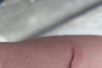 高雄男持鋼筆突襲　所長遭刺傷仍奮勇逮人法辦